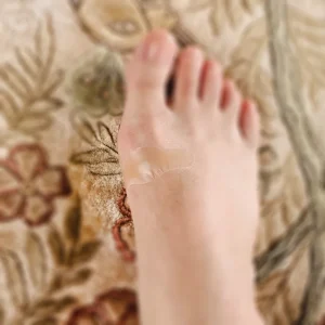 右足の親指付け根にできた靴擦れにキズパワーパッドを貼った様子